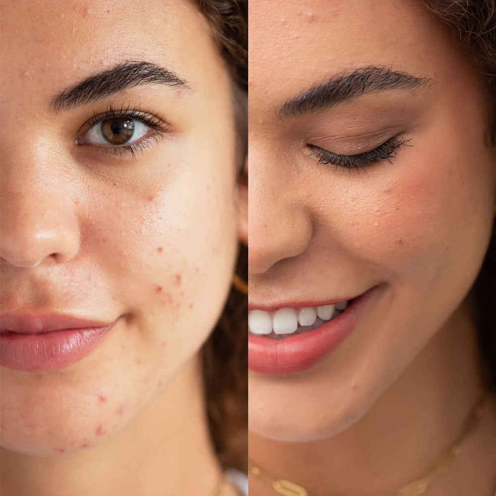 Arnica All-Cover Pot – Brew