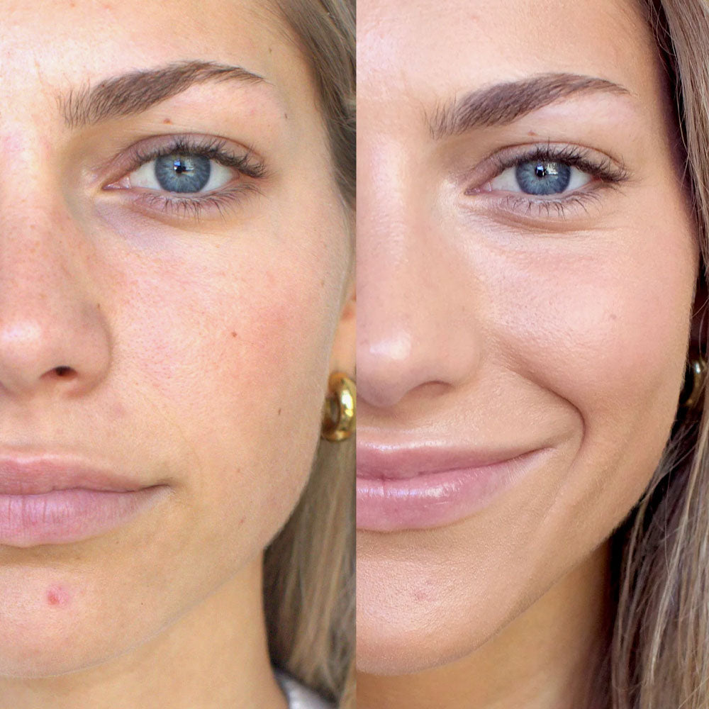 Arnica All-Cover Pot – Chai