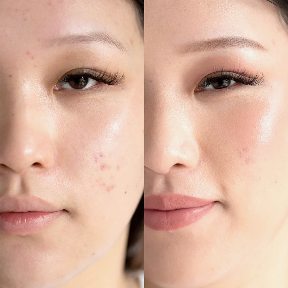 Arnica All-Cover Pot – Honey